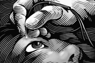 Wsjcanaloplasty Wsjcanaloplasty